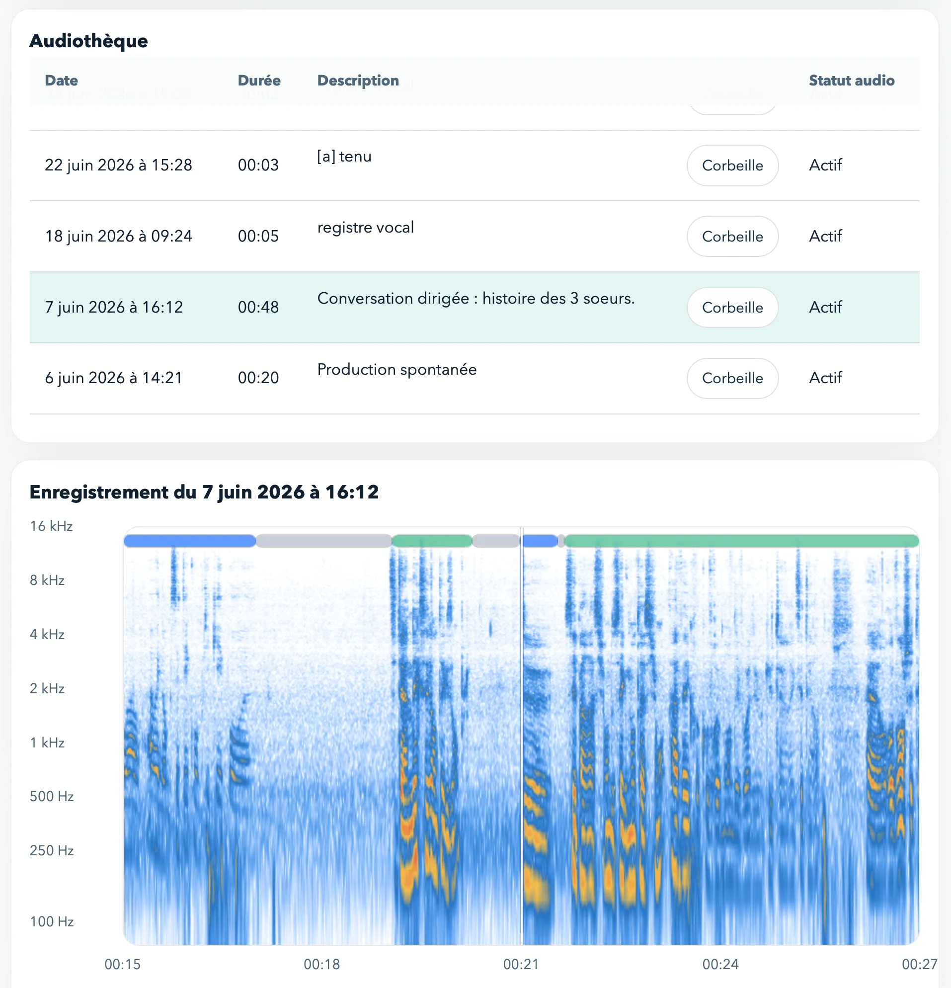 Vue de l’audiothèque et de l’écran d’enregistrement dans VocoSense.