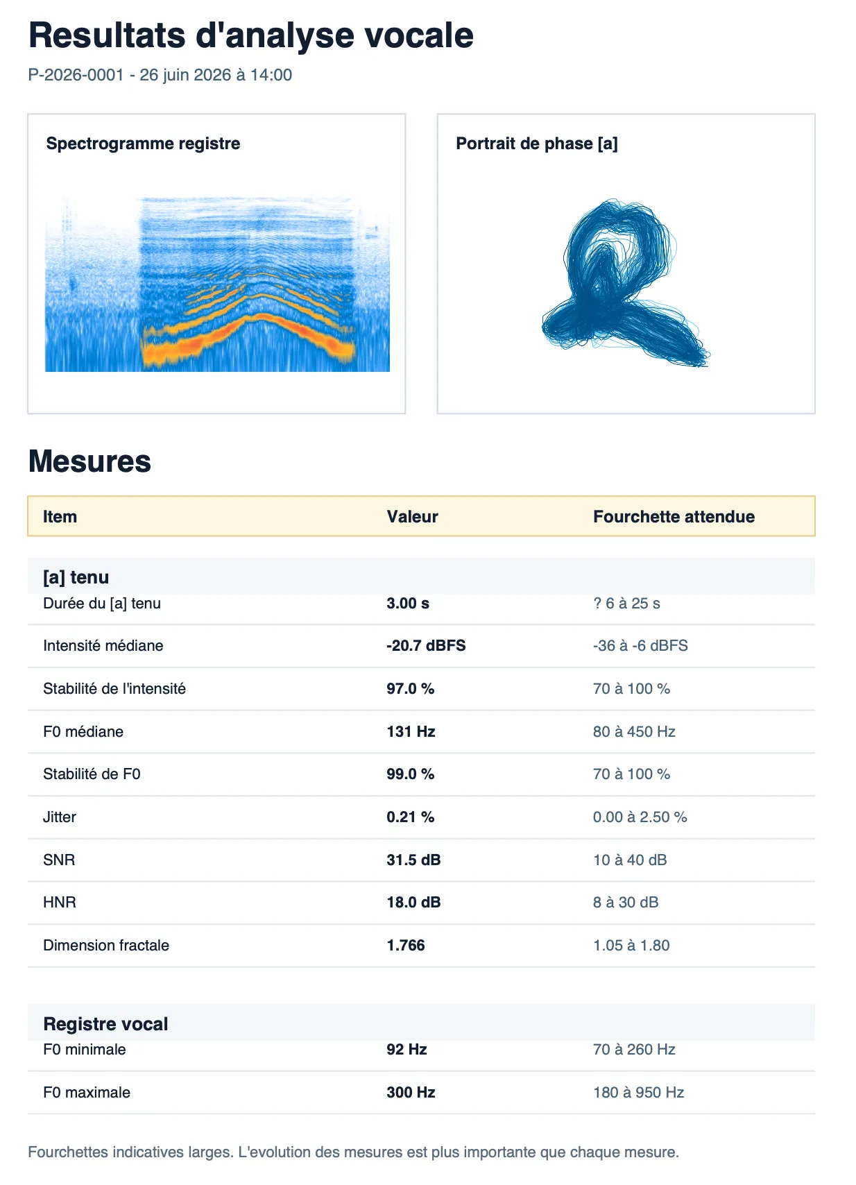Exemple de document PDF généré à partir d’une analyse locale dans VocoSense.